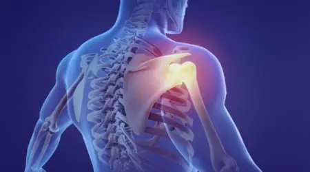 Nieuwe inzichten aspecifieke schouderpijn: klinisch redeneren & vaardigheden